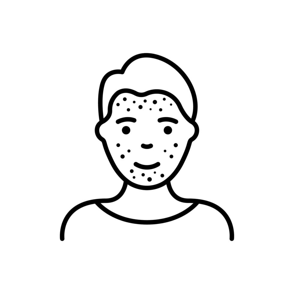 Boy with Blackhead, Acne, Rash on Face Line Icon. Man with Pimples Linear Pictogram. Allergy, Inflammation Skin, Dermatologic Problem Outline Icon. Isolated Vector Illustration.