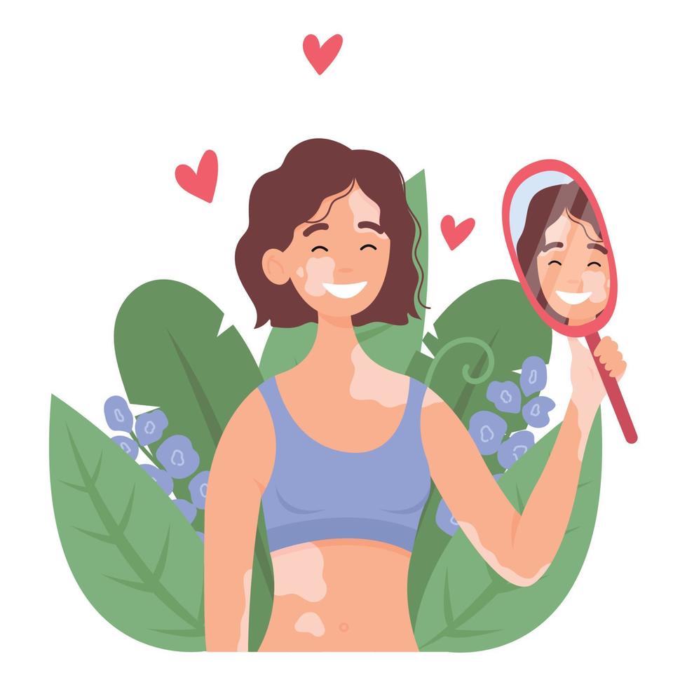 Smiling girls with vitiligo staring at her reflection in a mirror. The concept of accepting yourself. Self love. World Vitiligo Day vector