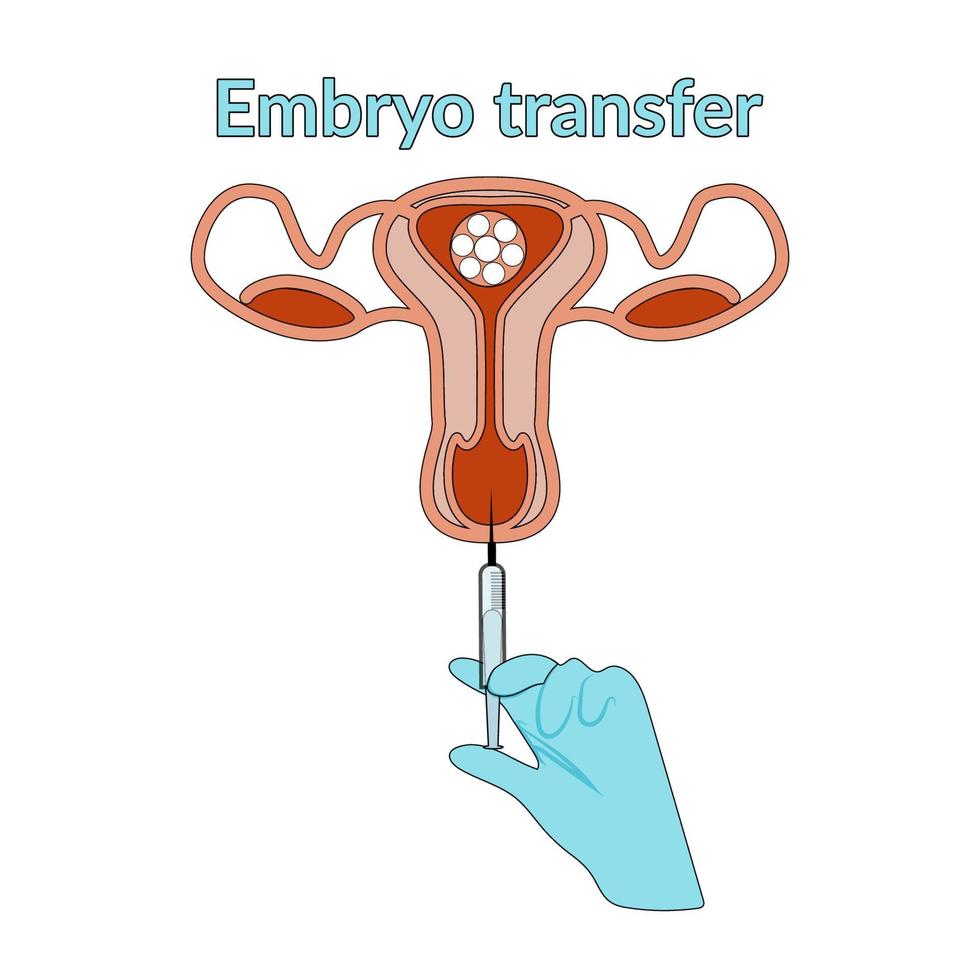 fertilización extracorpórea en estilo plano y dibujado a mano. diagrama de inseminación artificial. transferencia del óvulo fecundado al útero. transferencia de embrión. ilustración vectorial para un libro de texto de ciencia vector