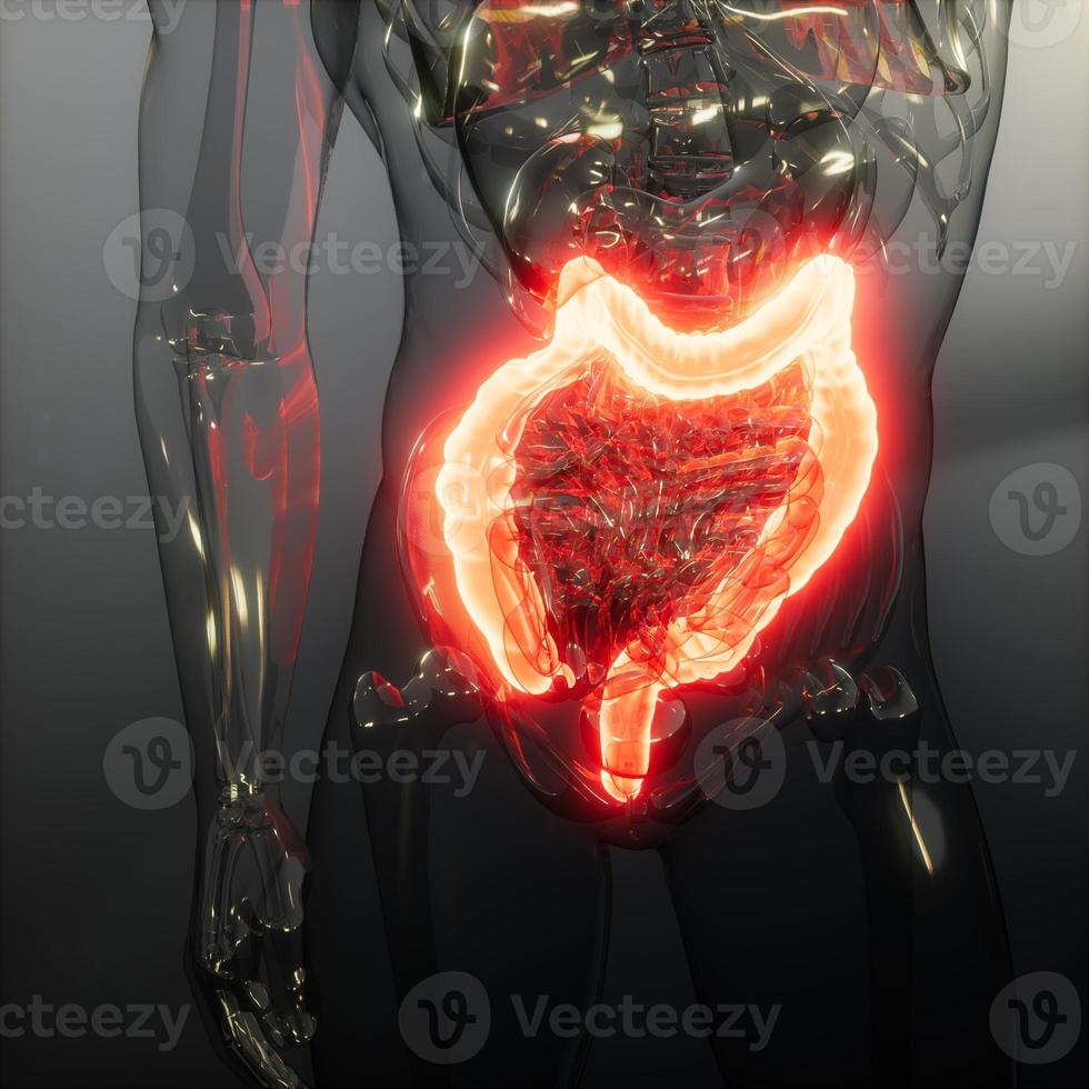 examen de radiología de colon humano foto