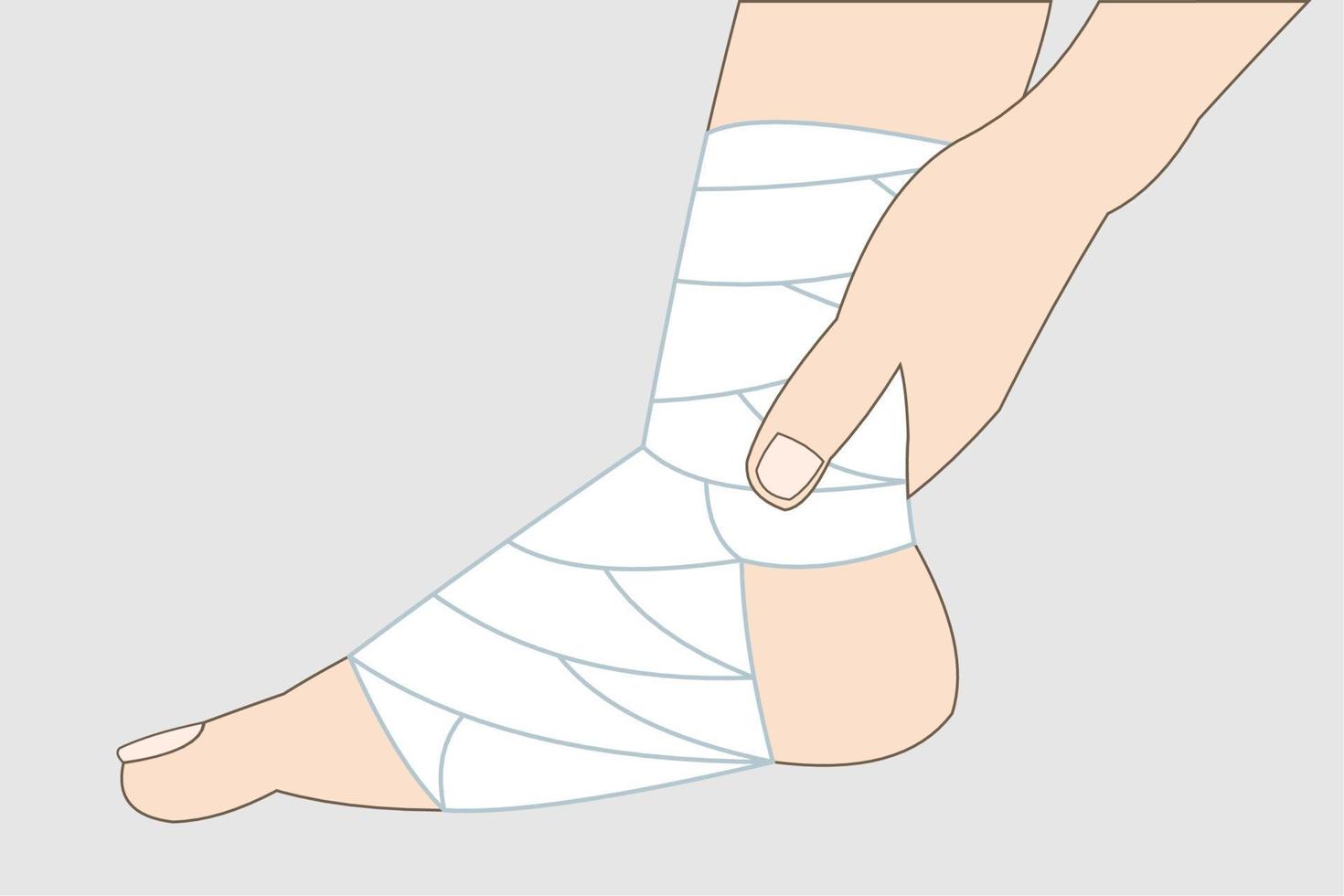 leg in a cast or bandage. vector illustration