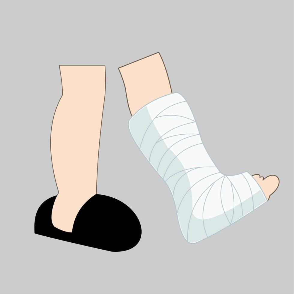 leg in a cast or bandage. vector illustration