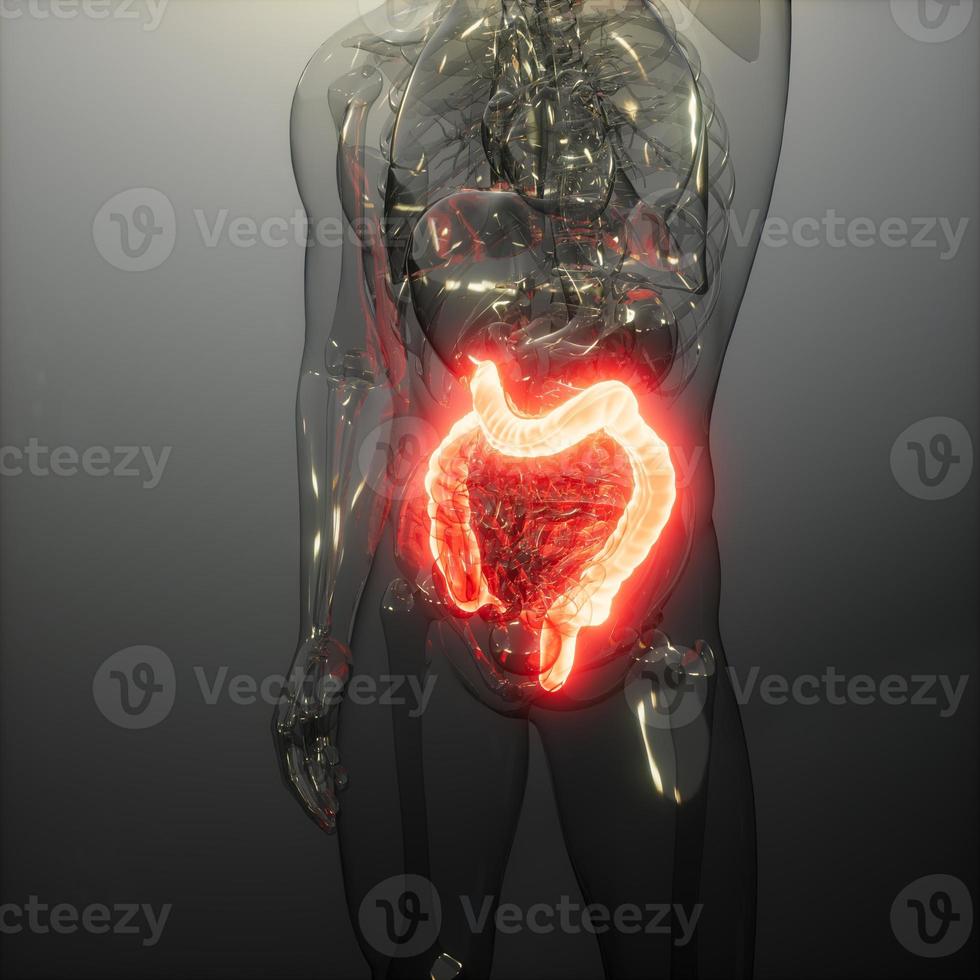 examen de radiología de colon humano foto