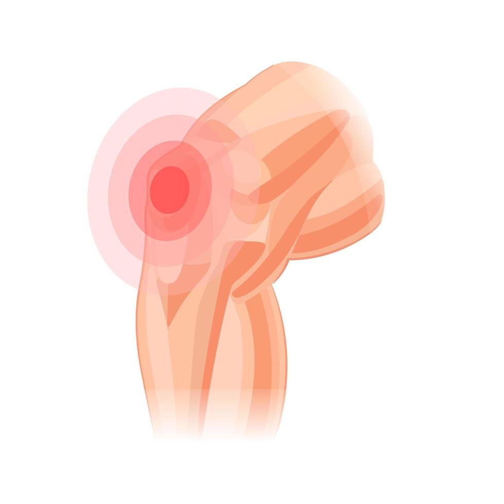 la rodilla humana duele. dolor en la rodilla artritis. anatomía humana. ilustración vectorial aislado sobre fondo blanco. vector
