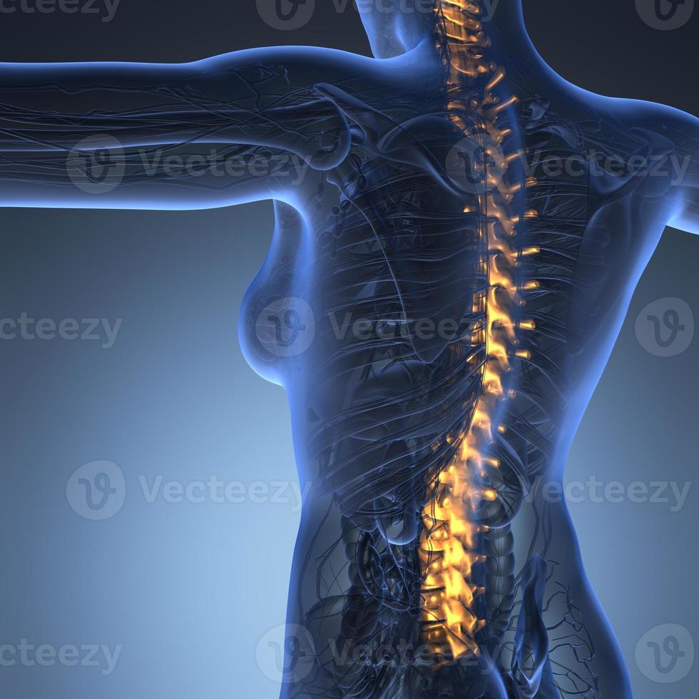 Human backache and back pain with an upper torso body skeleton showing the spine and vertebral column photo