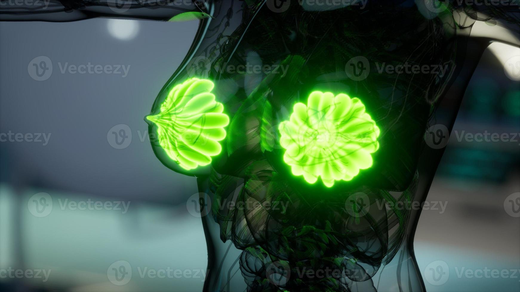 medical scan of Woman Breast photo