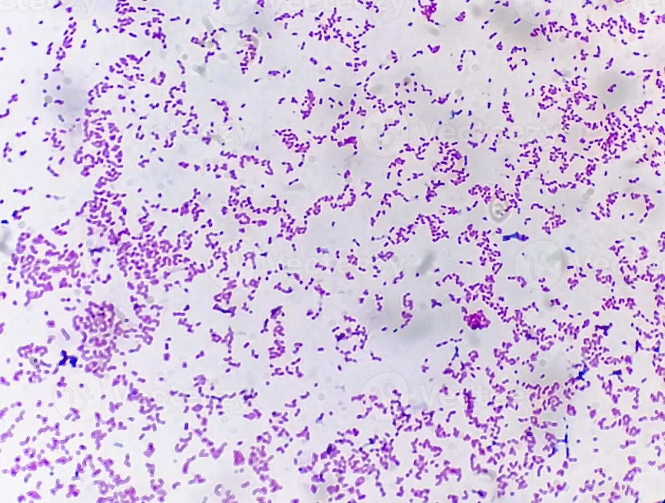 Escherichia coli bacterium, E.coli, gram-negative rod-shaped bacteria, part of intestinal normal flora and causative agent of diarrhea and inflammations of different location. Close up micrograph photo
