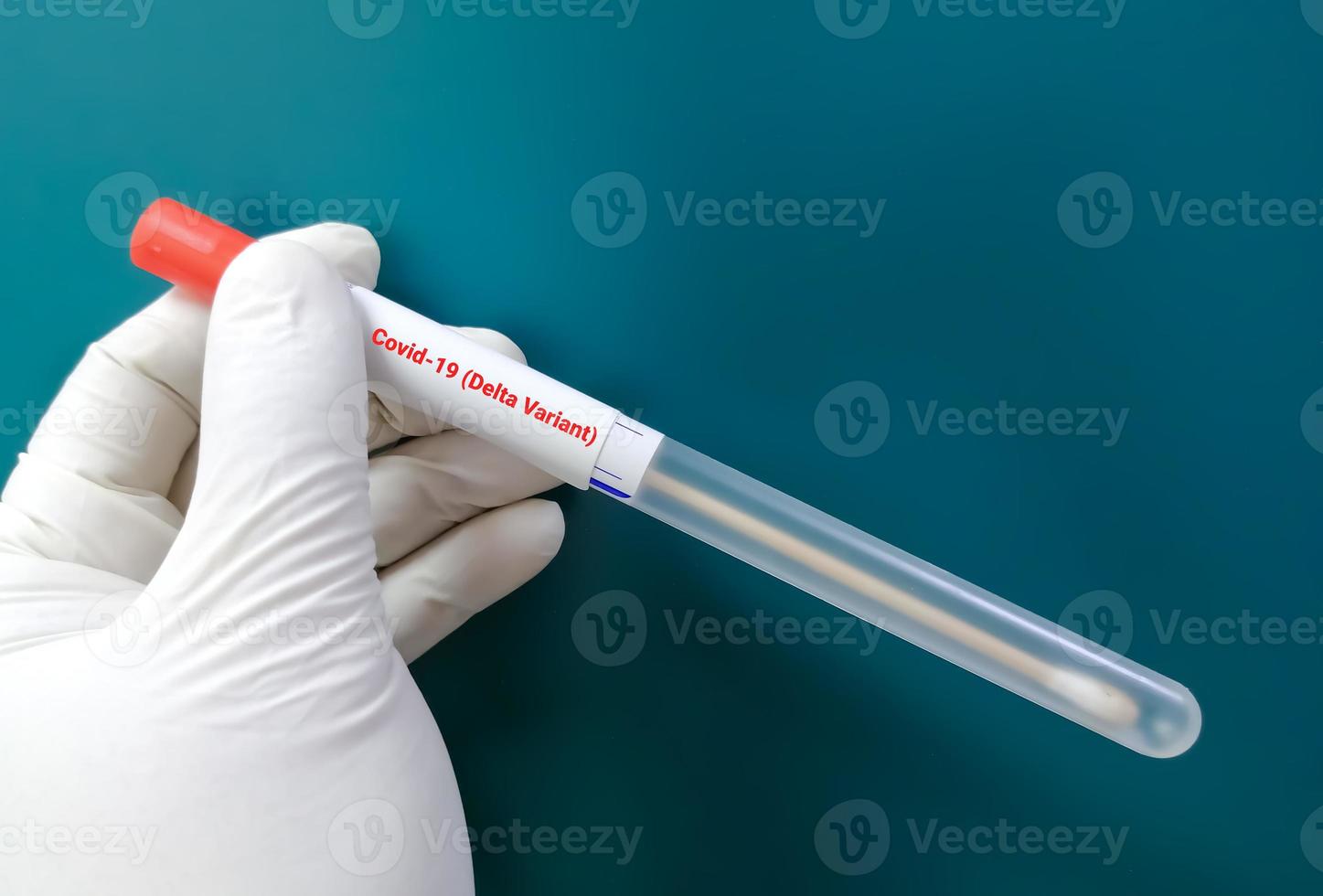 Medical healthcare technician holding COVID-19 swab collection kit for Delta variant, test tube for taking OP NP patient specimen sample, PCR lab testing. photo