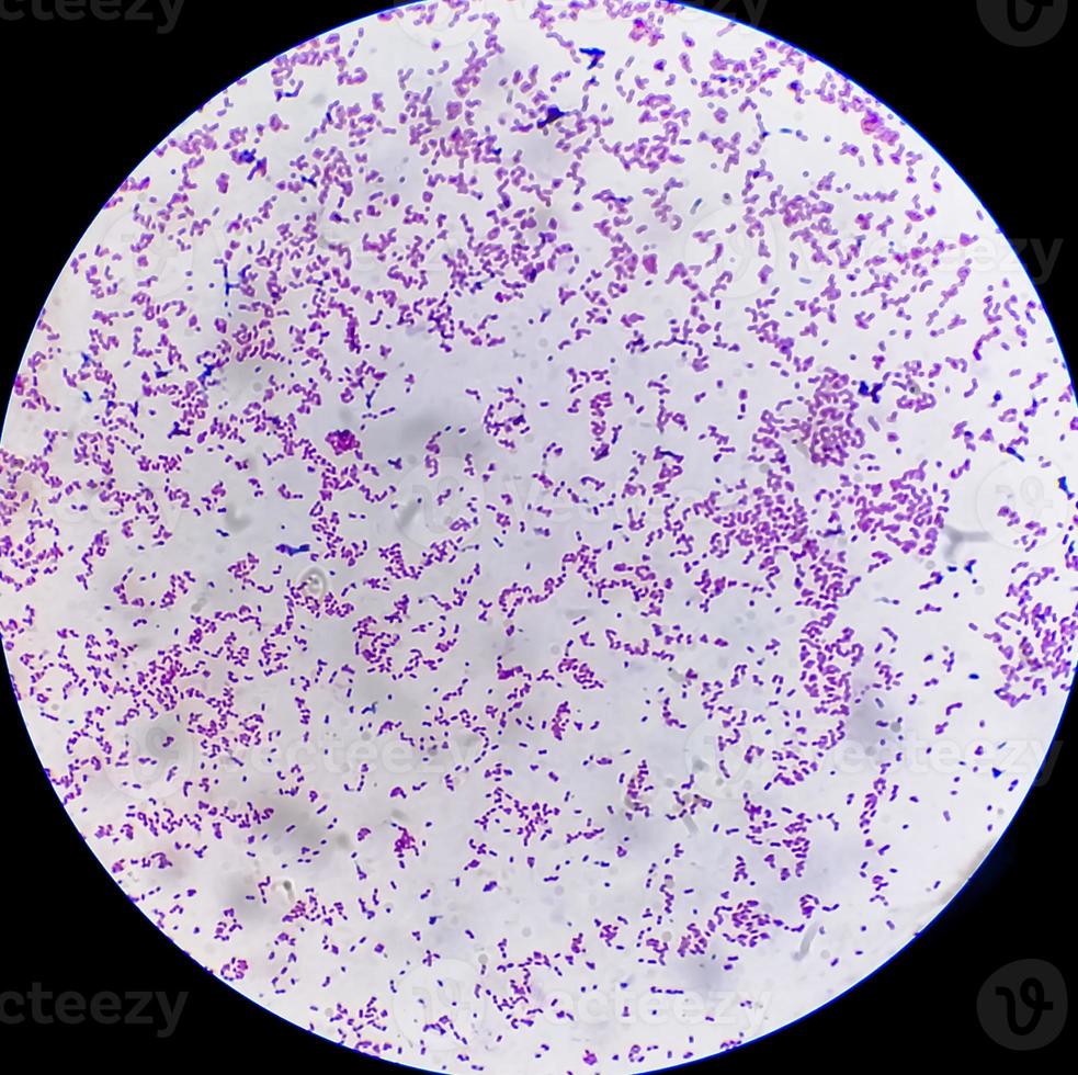 Escherichia coli bacterium, E.coli, gram-negative rod-shaped bacteria, part of intestinal normal flora and causative agent of diarrhea and inflammations of different location. Close up micrograph photo