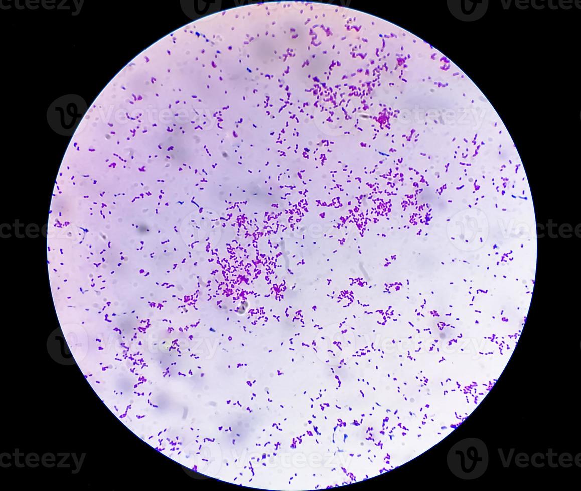 Escherichia coli bacterium, E.coli, gram-negative rod-shaped bacteria, part of intestinal normal flora and causative agent of diarrhea and inflammations of different location. Close up micrograph photo