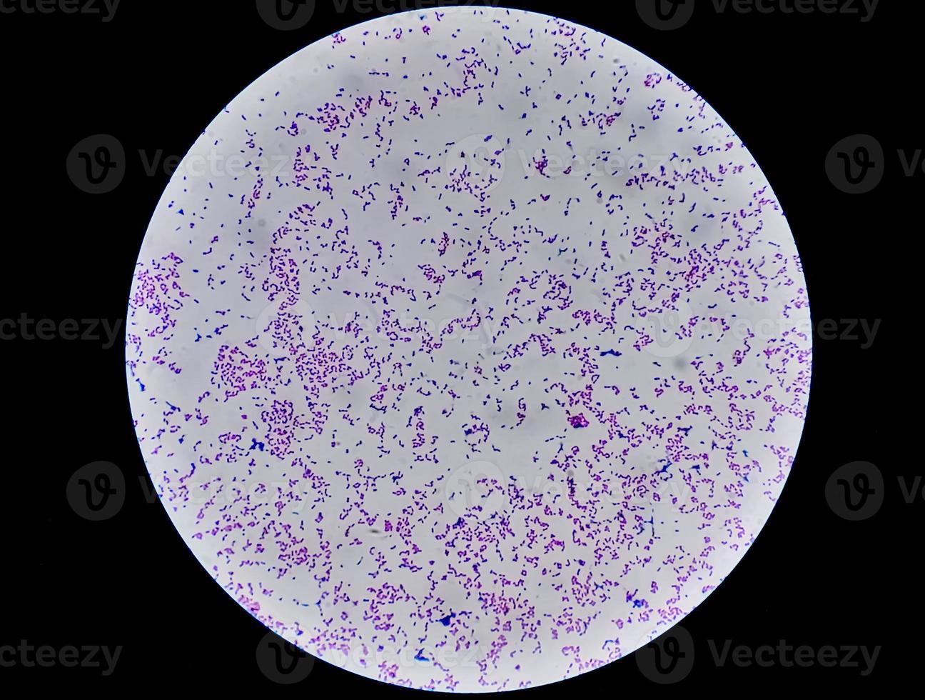 Escherichia coli bacterium, E.coli, gram-negative rod-shaped bacteria, part of intestinal normal flora and causative agent of diarrhea and inflammations of different location. Close up micrograph photo