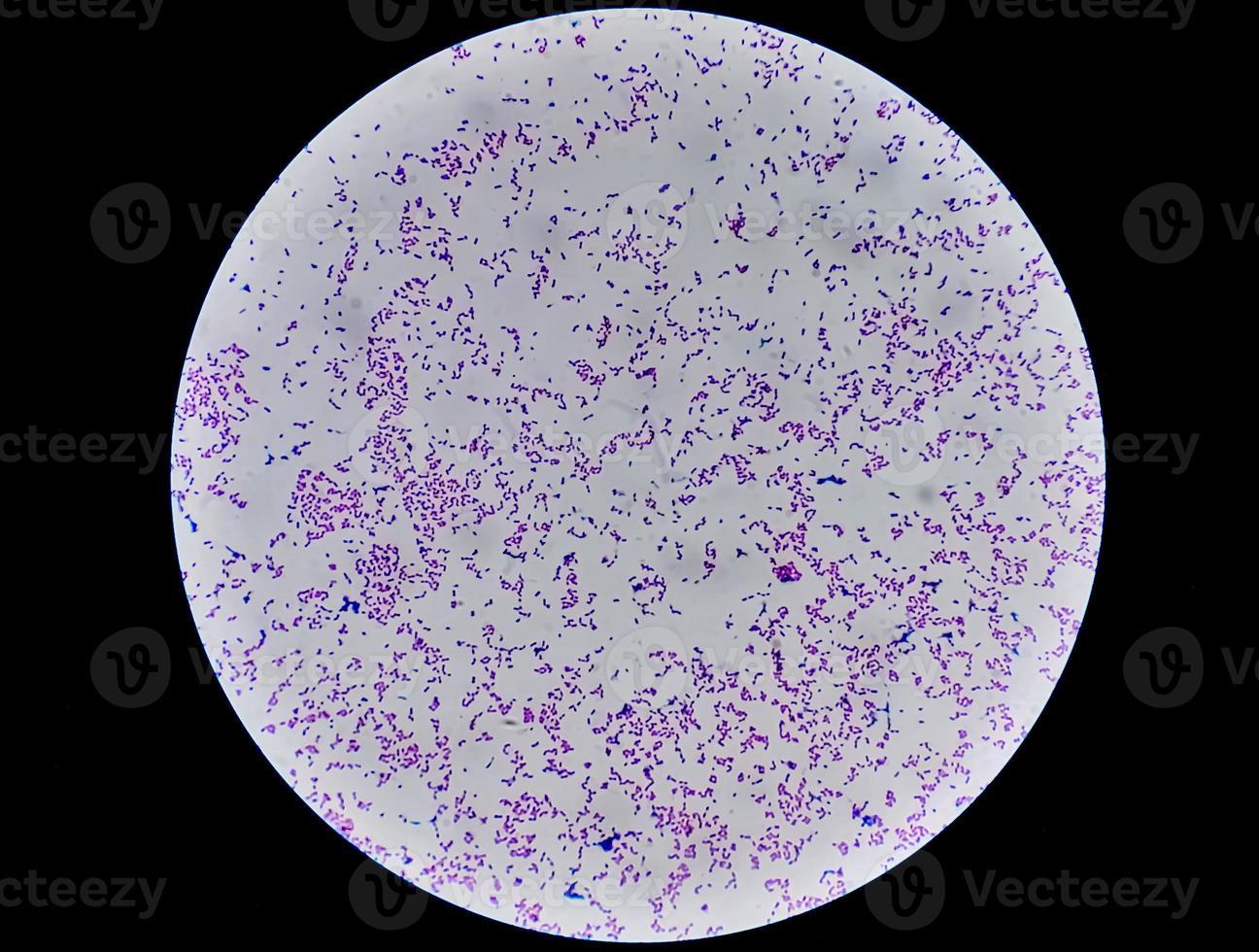 Escherichia coli bacterium, E.coli, gram-negative rod-shaped bacteria, part of intestinal normal flora and causative agent of diarrhea and inflammations of different location. Close up micrograph photo