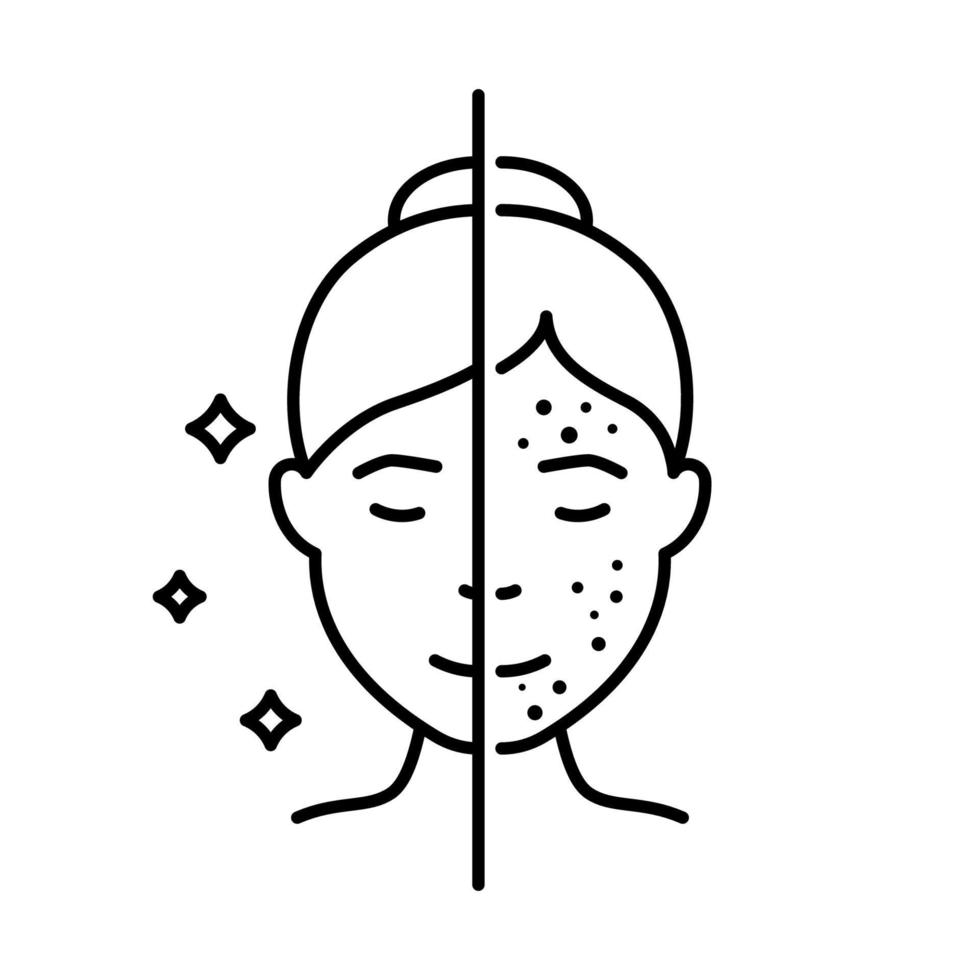 Woman with Acne and Clean Face Skin Line Icon. Girl Before and After Skin Treatment Linear Pictogram. Female Skincare for Cleansing Face Outline Icon. Isolated Vector Illustration.