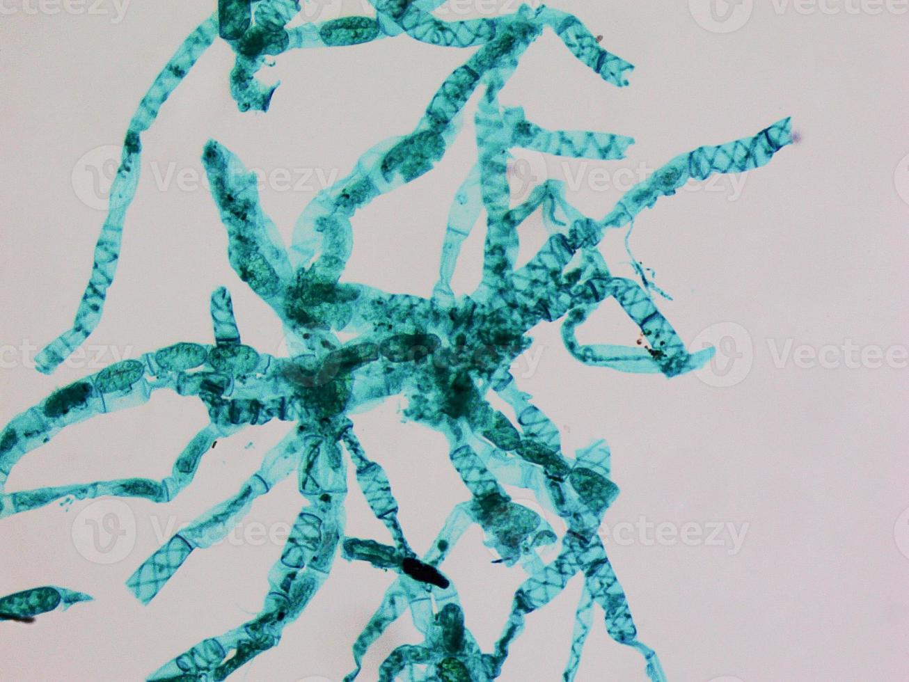 Spirogyra cells micrograph photo