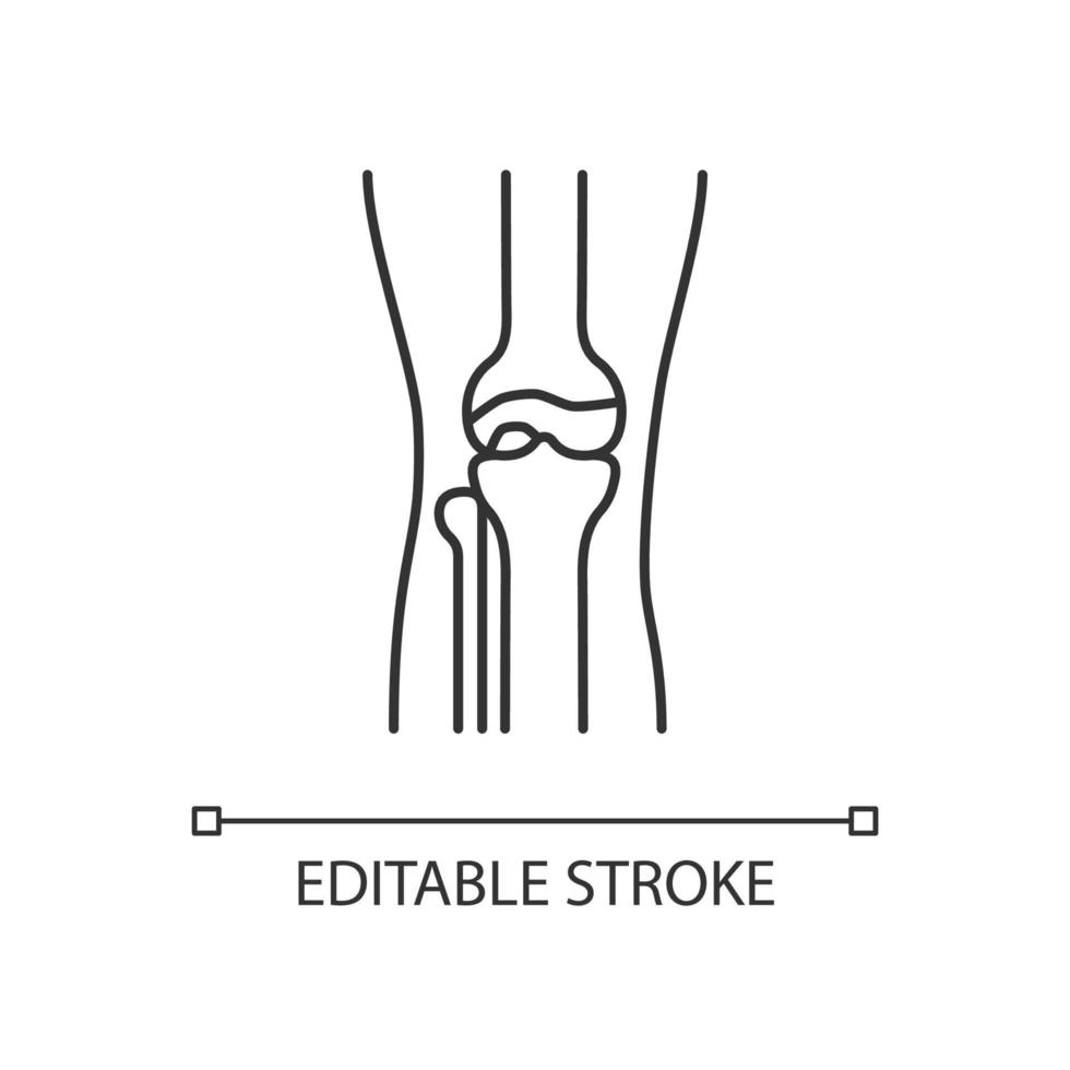 icono lineal de osteoartritis. inflamación del cartílago. enfermedad degenerativa de las articulaciones. dolor en la rodilla. ilustración personalizable de línea delgada. símbolo de contorno dibujo de contorno aislado vectorial. trazo editable vector