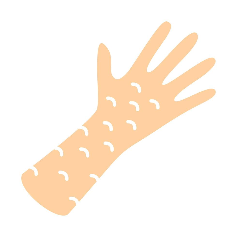 Skin rash flat design long shadow color icon. Food, medication allergy reaction. Hives, eczema, psoriasis. Irritation on hand. Rubeola, measles symptom. Vector silhouette illustration