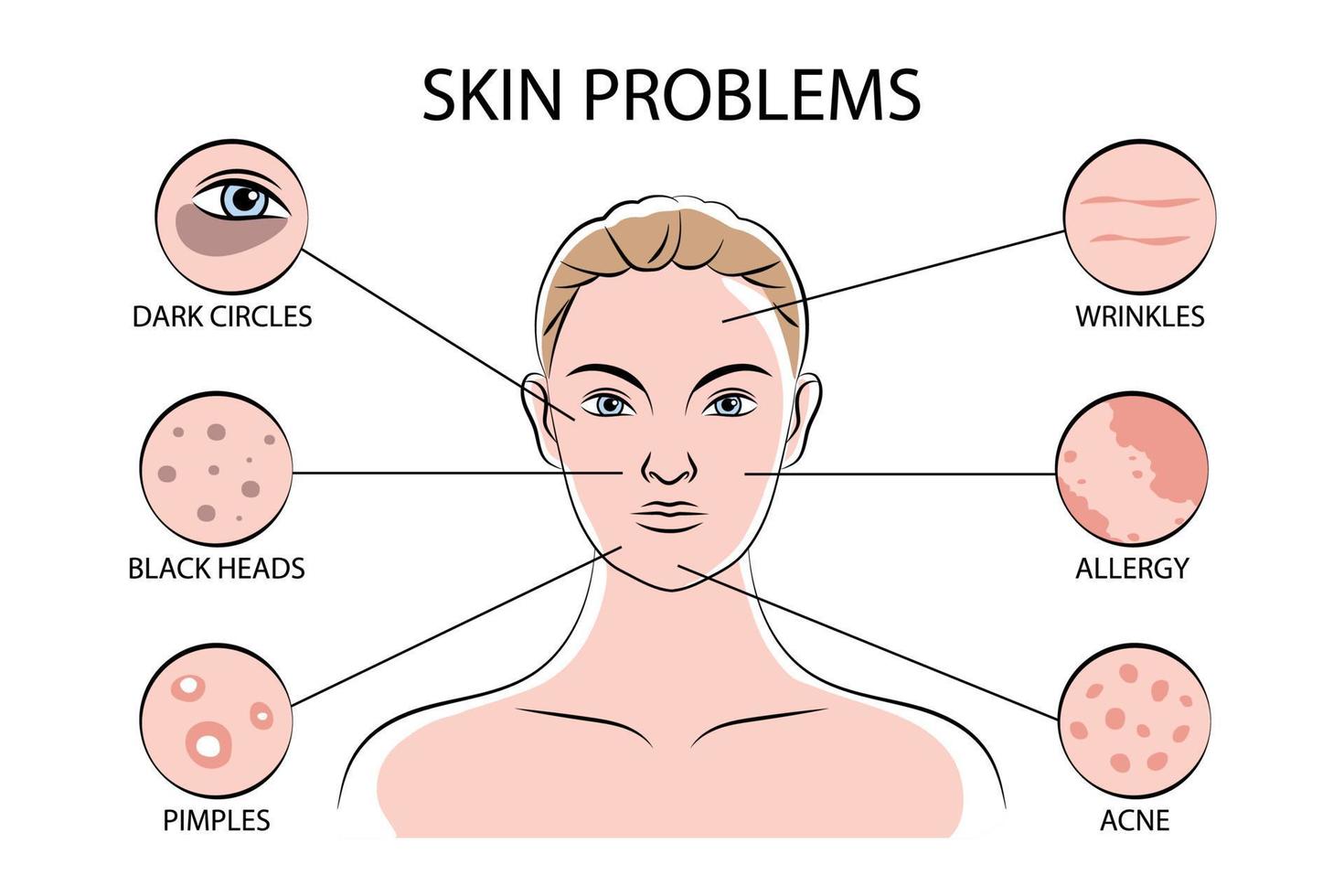 infografías de problemas de la piel vector