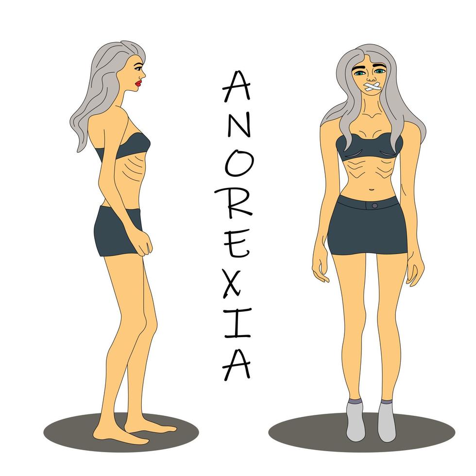 mujer que sufre de anorexia, pérdida de peso severa. el cuerpo delgado de la mujer se ve recto y de lado. morena muy delgada con las consecuencias del síndrome de anorexia. bulimia enfermedad. vector. eps 10 vector