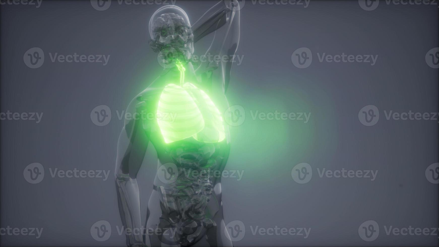 Human Lungs Radiology Exam photo