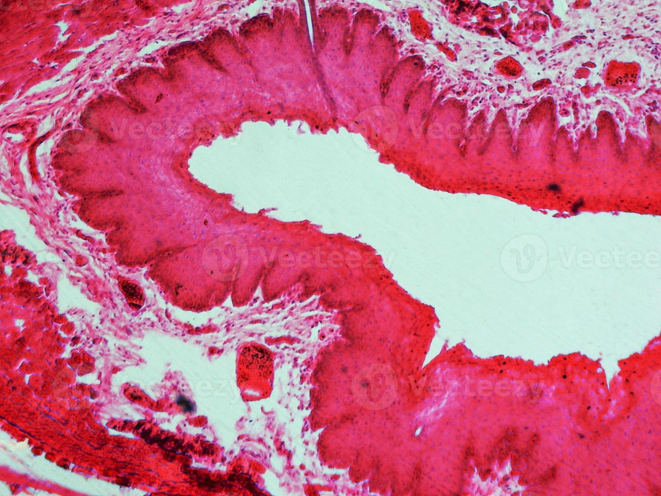 Epithelium cells micrograph photo