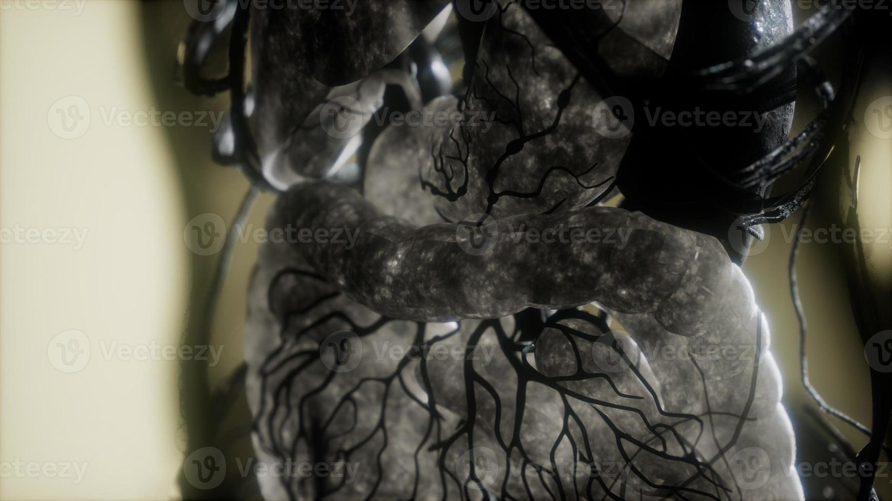 Contrast MRI of the human body organs photo