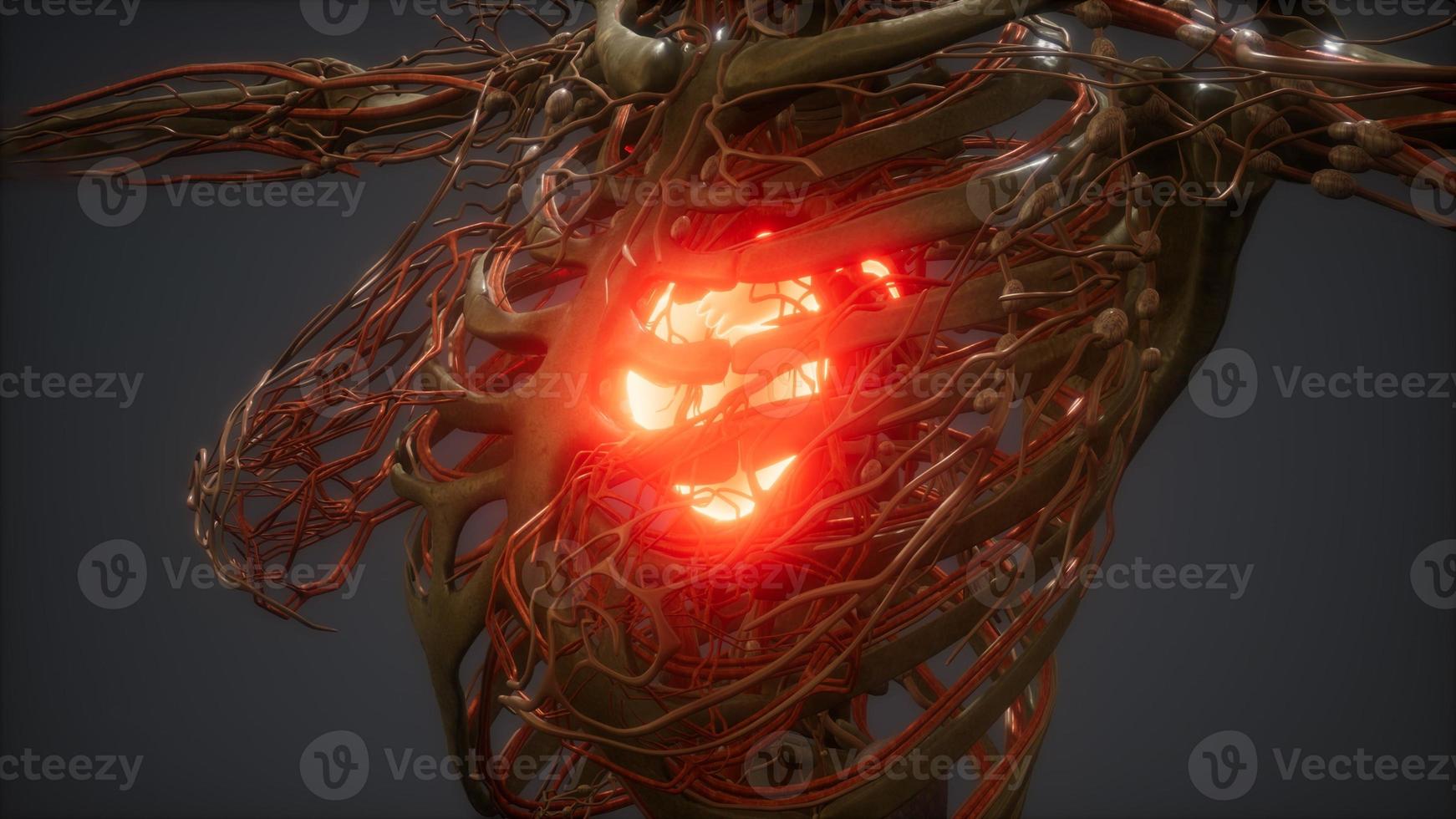 CG Animation Of A Sick Human Heart photo