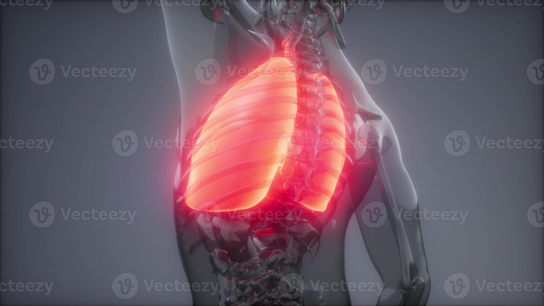 Human Lungs Radiology Exam photo