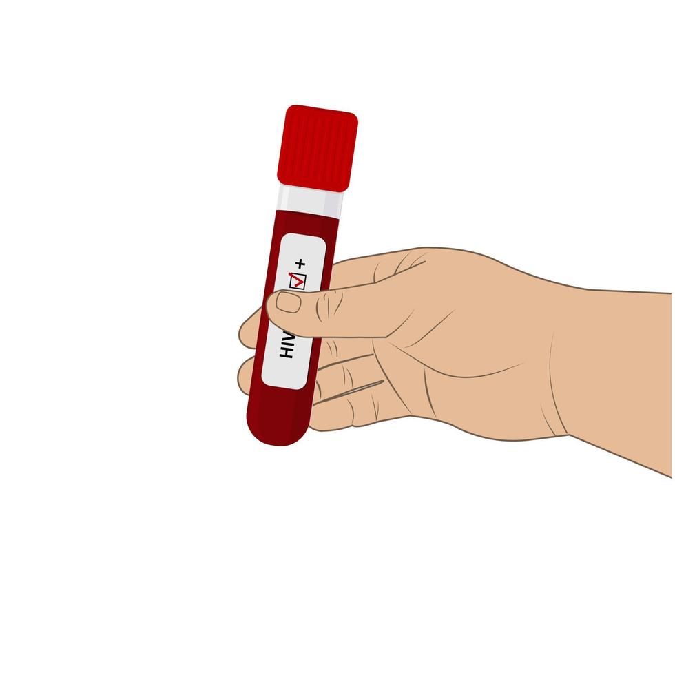 An HIV testing kit with a laboratory test tube for blood analysis. Vector illustration.