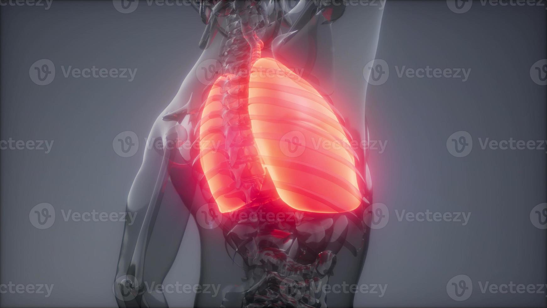 Human Lungs Radiology Exam photo