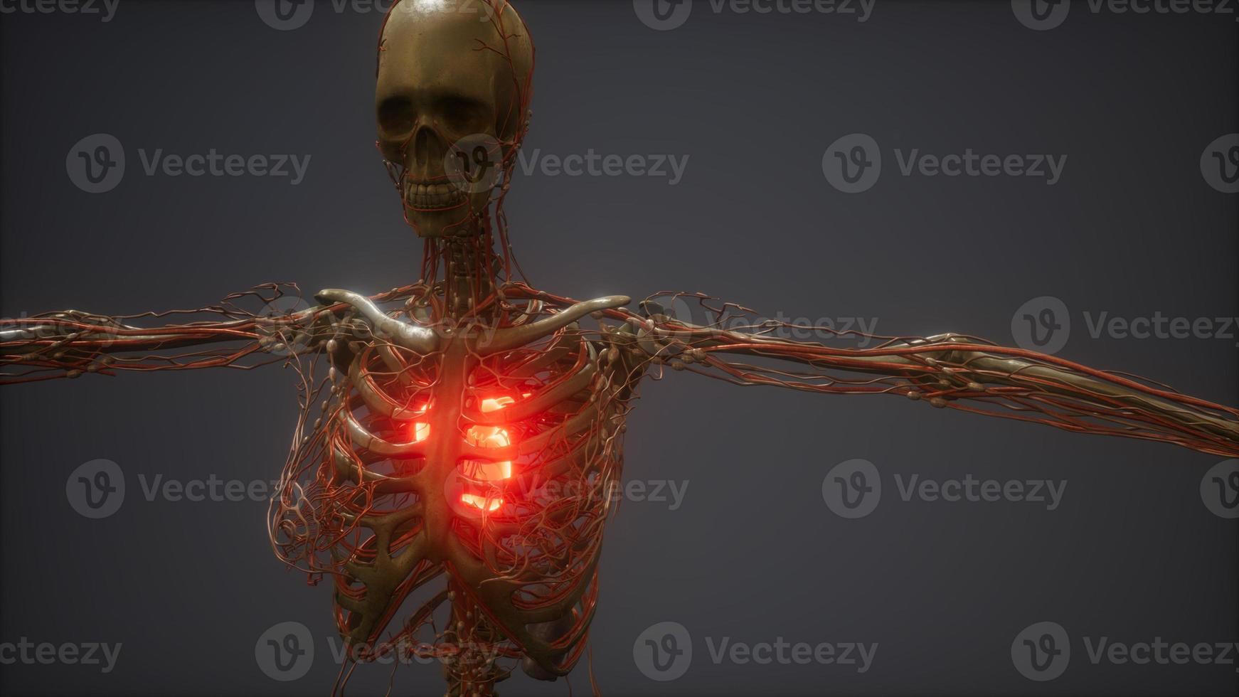 CG Animation Of A Sick Human Heart photo