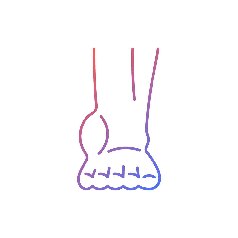Ankle inflammation gradient linear vector icon. Swollen foot and ankle. Osteoarthritis development. Tendonitis. Thin line color symbol. Modern style pictogram. Vector isolated outline drawing