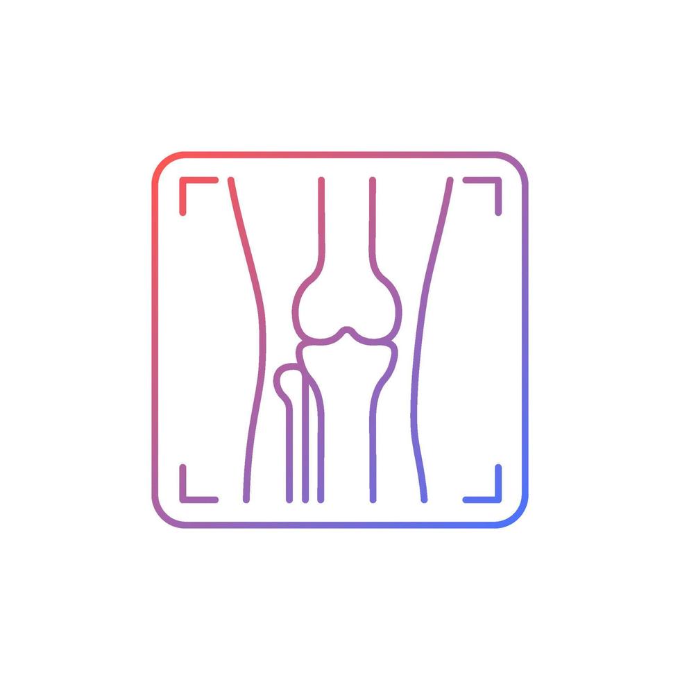 icono de vector lineal de gradiente de rayos x de artritis. representación de deformidad articular. diagnóstico de artrosis. imagenes medicas. símbolo de color de línea delgada. pictograma de estilo moderno. dibujo de contorno aislado vectorial