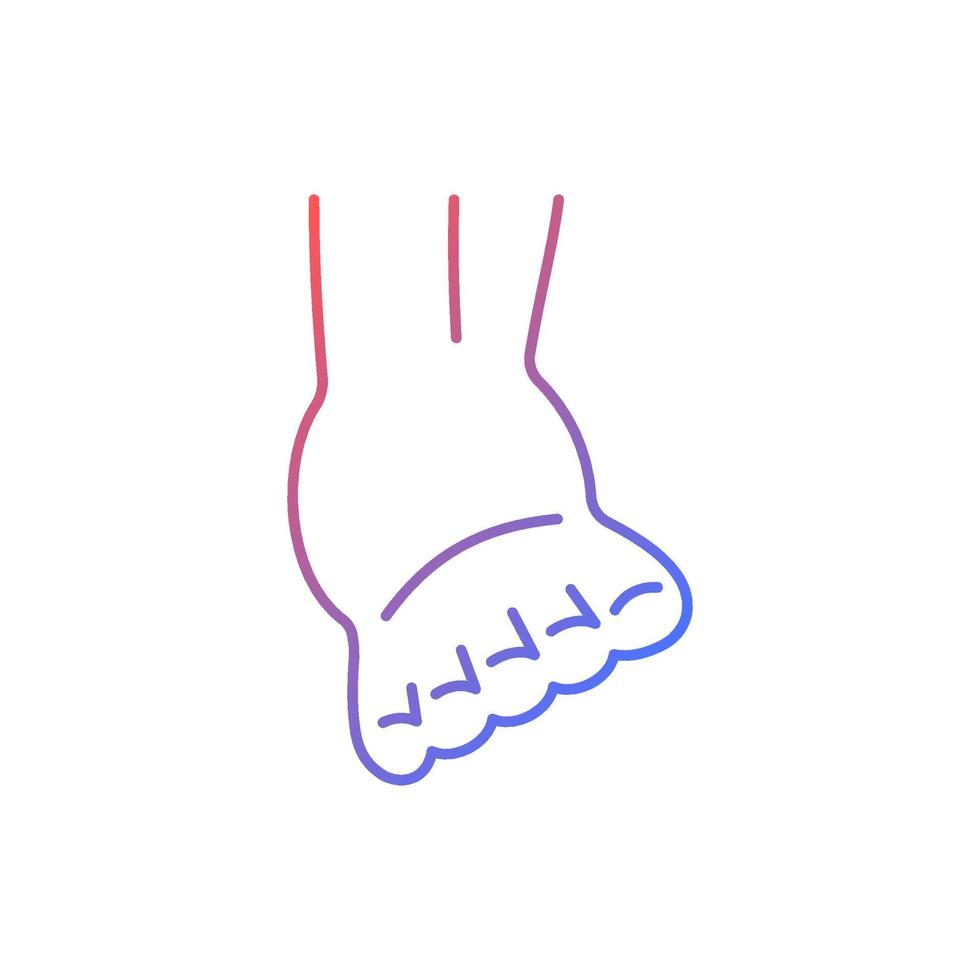Joint sprain gradient linear vector icon. Ankle ligaments tearing. Sports injury. Overstretched joint. Muscle damage. Thin line color symbol. Modern style pictogram. Vector isolated outline drawing