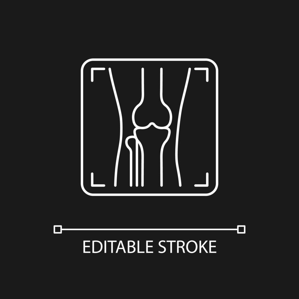 Arthritis x ray white linear icon for dark theme. Joint deformity. Osteoarthritis diagnosis. Thin line customizable illustration. Isolated vector contour symbol for night mode. Editable stroke