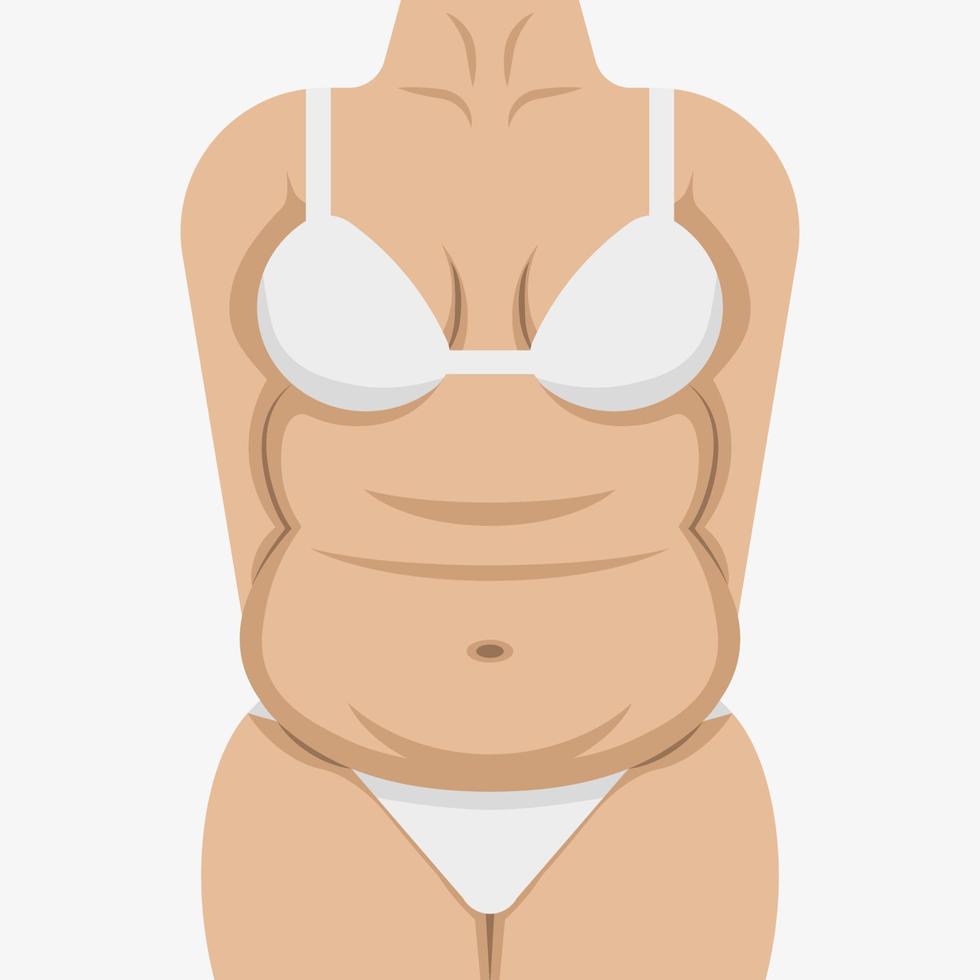 Fat female body with white underwear vector illustration. Chubby woman figure icon. Plus size lady isolated on white background