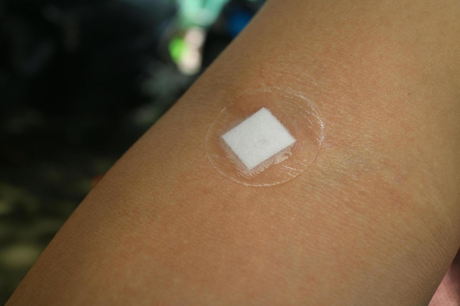 injection plaster cover on the hand photo