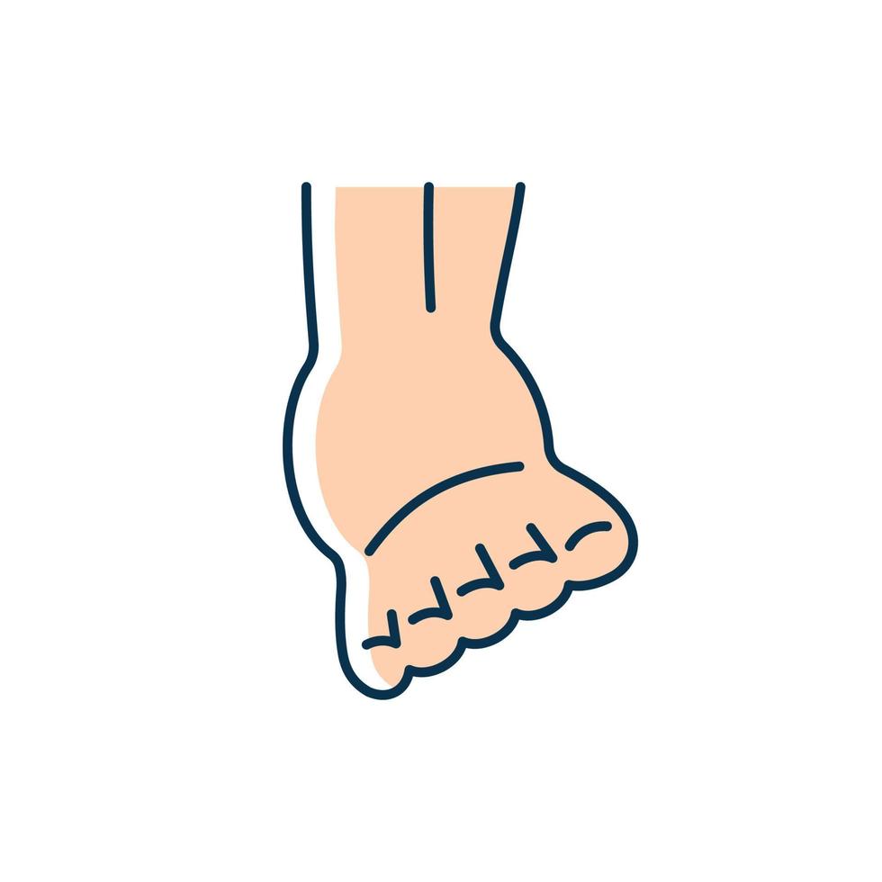 Joint sprain RGB color icon. Ankle ligaments tearing. Sports injury. Overstretched joint. Intense pain and swelling in ankle. Muscle damage. Isolated vector illustration. Simple filled line drawing