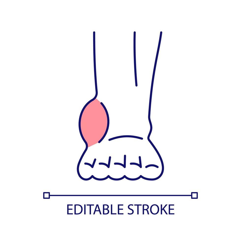 Ankle inflammation RGB color icon. Painful swelling. Foot disease and trauma. Joint disorder. Arthritis and arthrosis. Isolated vector illustration. Simple filled line drawing. Editable stroke