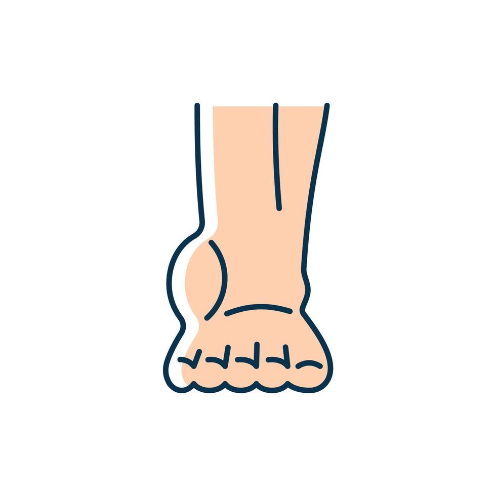 Ankle inflammation RGB color icon. Swollen foot and ankle. Osteoarthritis development. Soft-tissue injury. Sore ankle muscles. Tendonitis. Isolated vector illustration. Simple filled line drawing