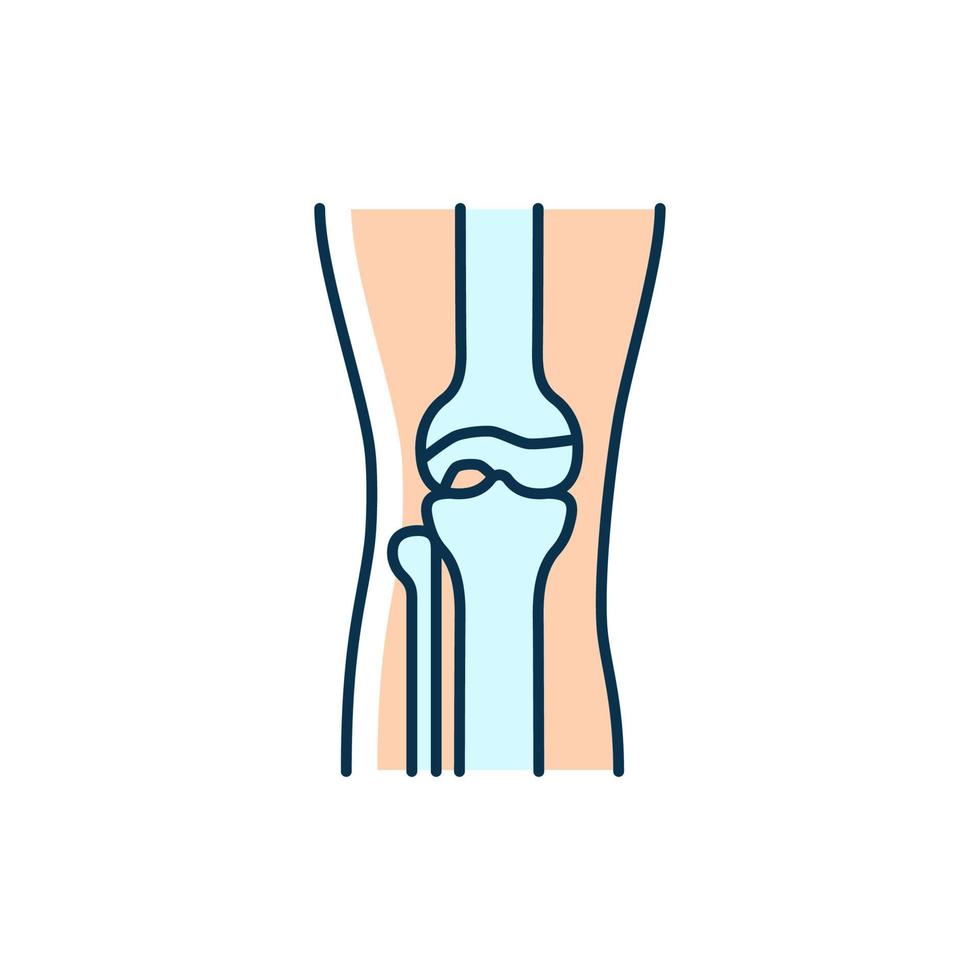 icono de color rgb de osteoartritis. inflamación del cartílago. enfermedad degenerativa de las articulaciones. dolor crónico en la rodilla. juntas desgastadas. condición autoinmune. ilustración vectorial aislada. dibujo lineal relleno simple vector