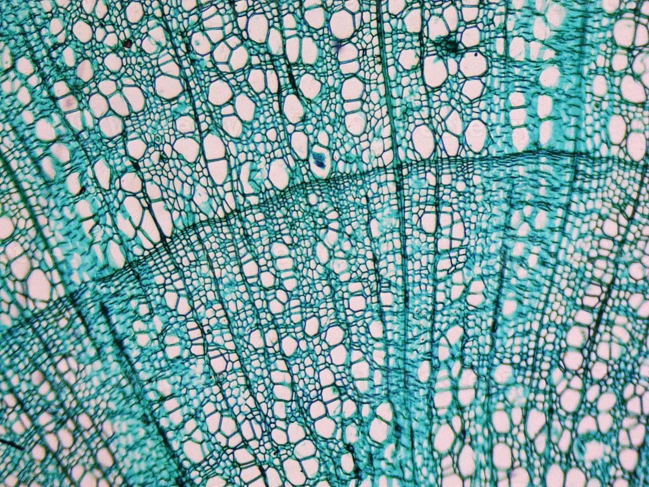 Tilia stem micrograph photo