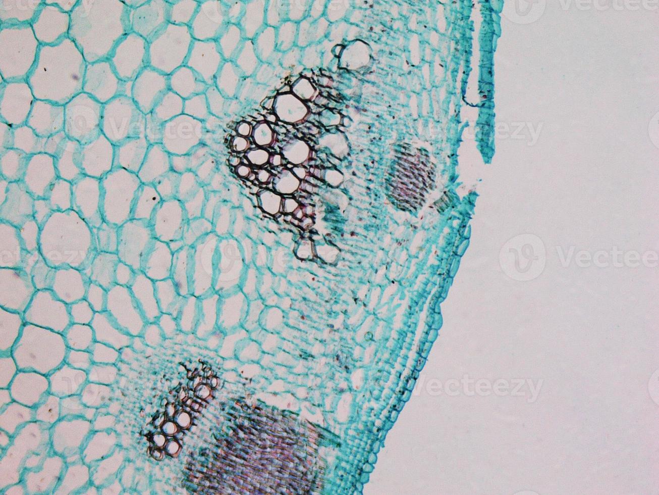 Heliansthus stem micrograph photo
