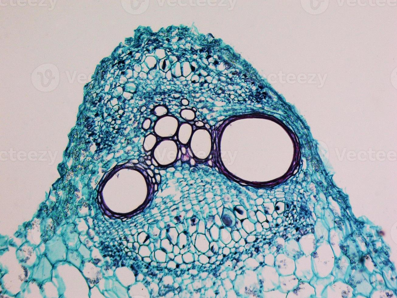 Cucurbita stem micrograph photo