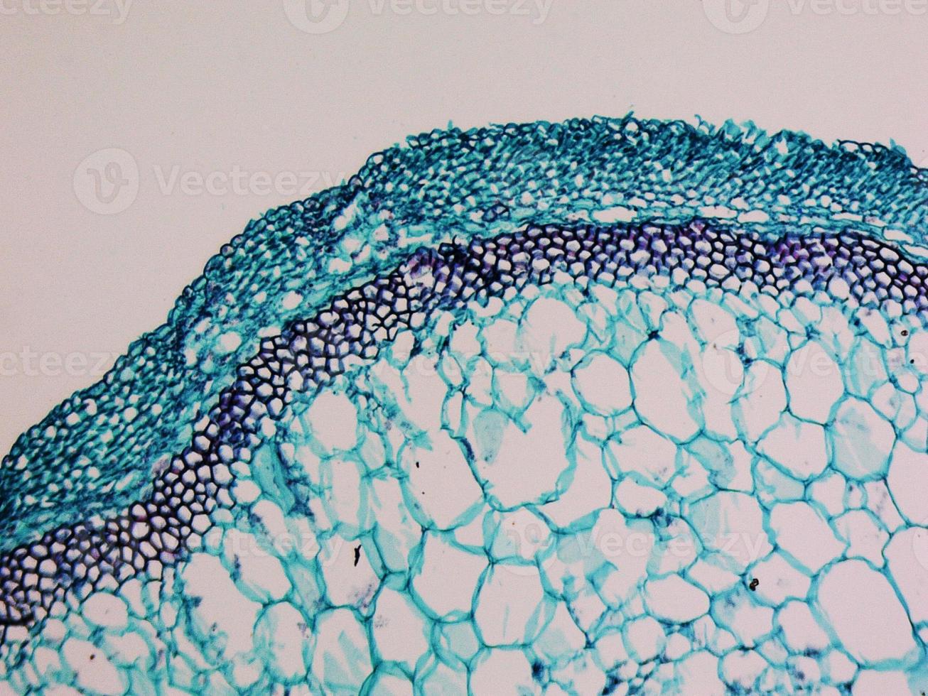 Cucurbita stem micrograph photo