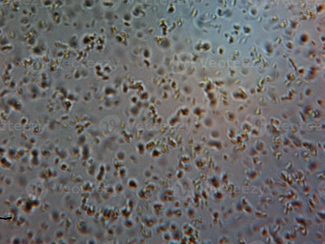 Light micrograph of Lactobacillus Vulgaris photo