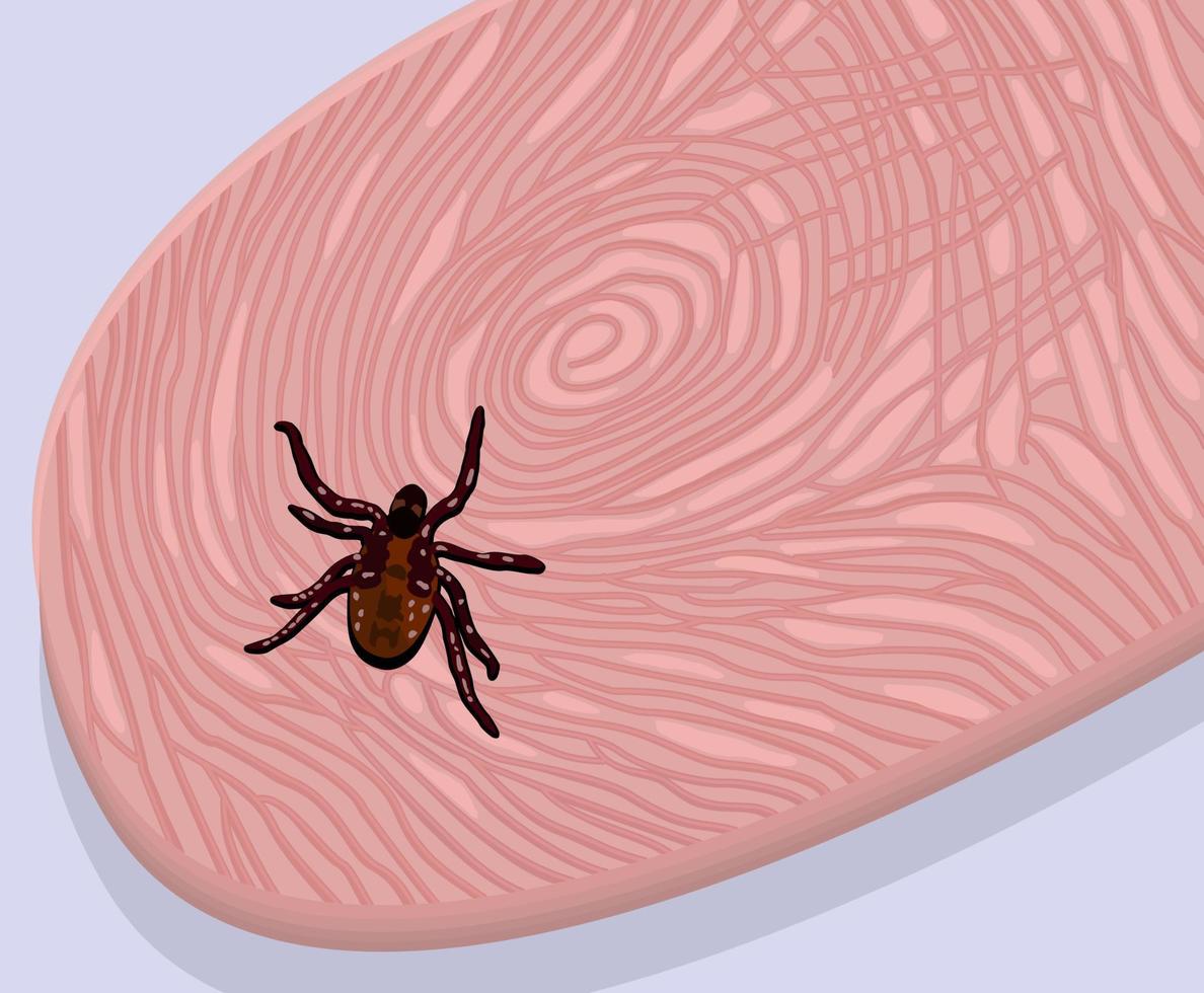 Vector illustration of tick on the finger.