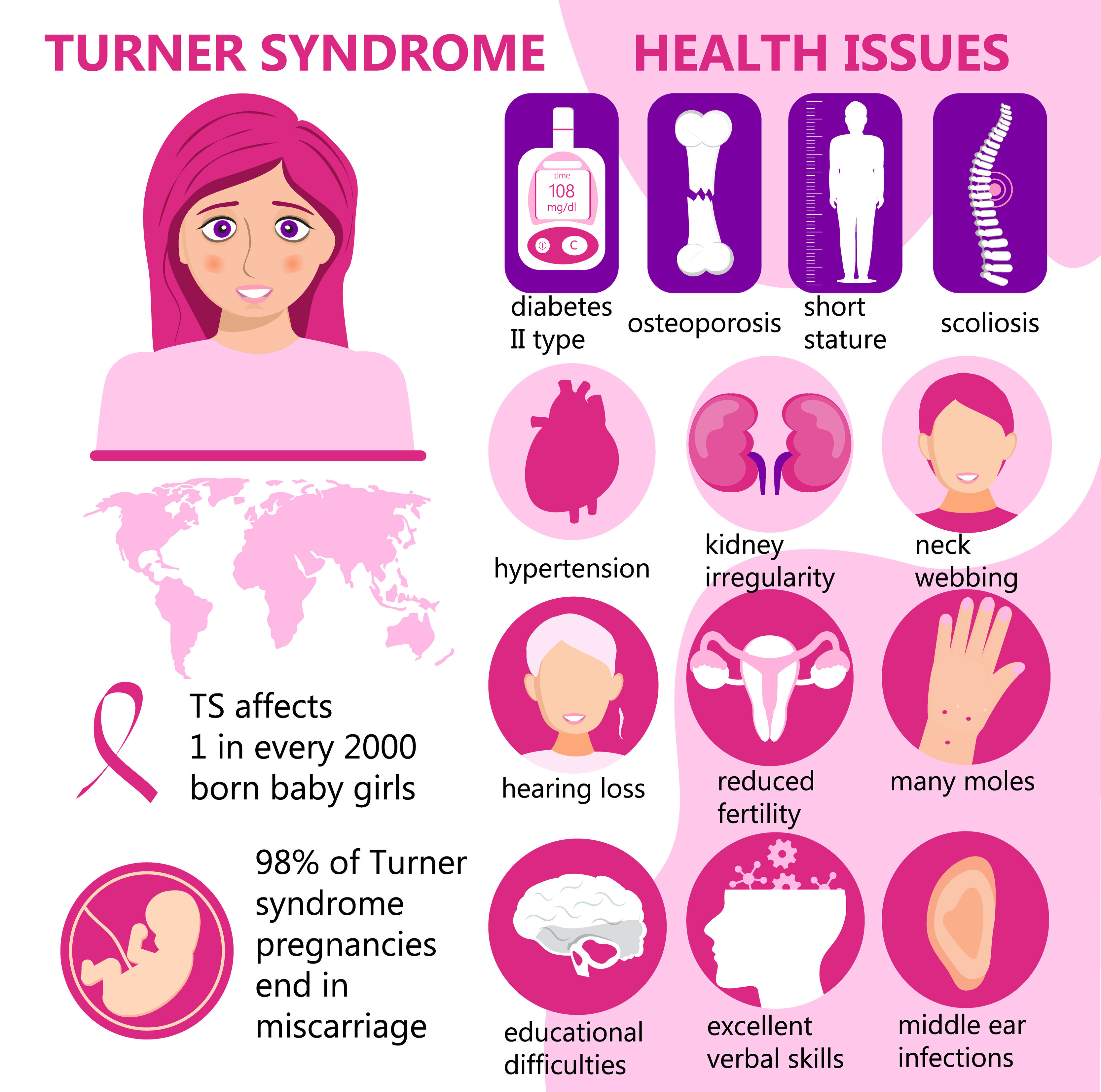 vector infográfico del síndrome de Turner. signos, problemas de salud