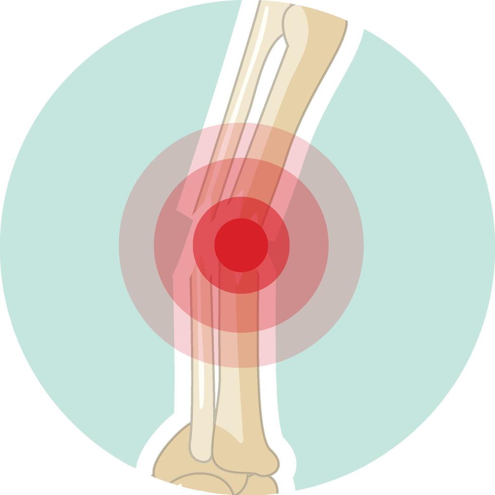 Arm joint with a red signal vector