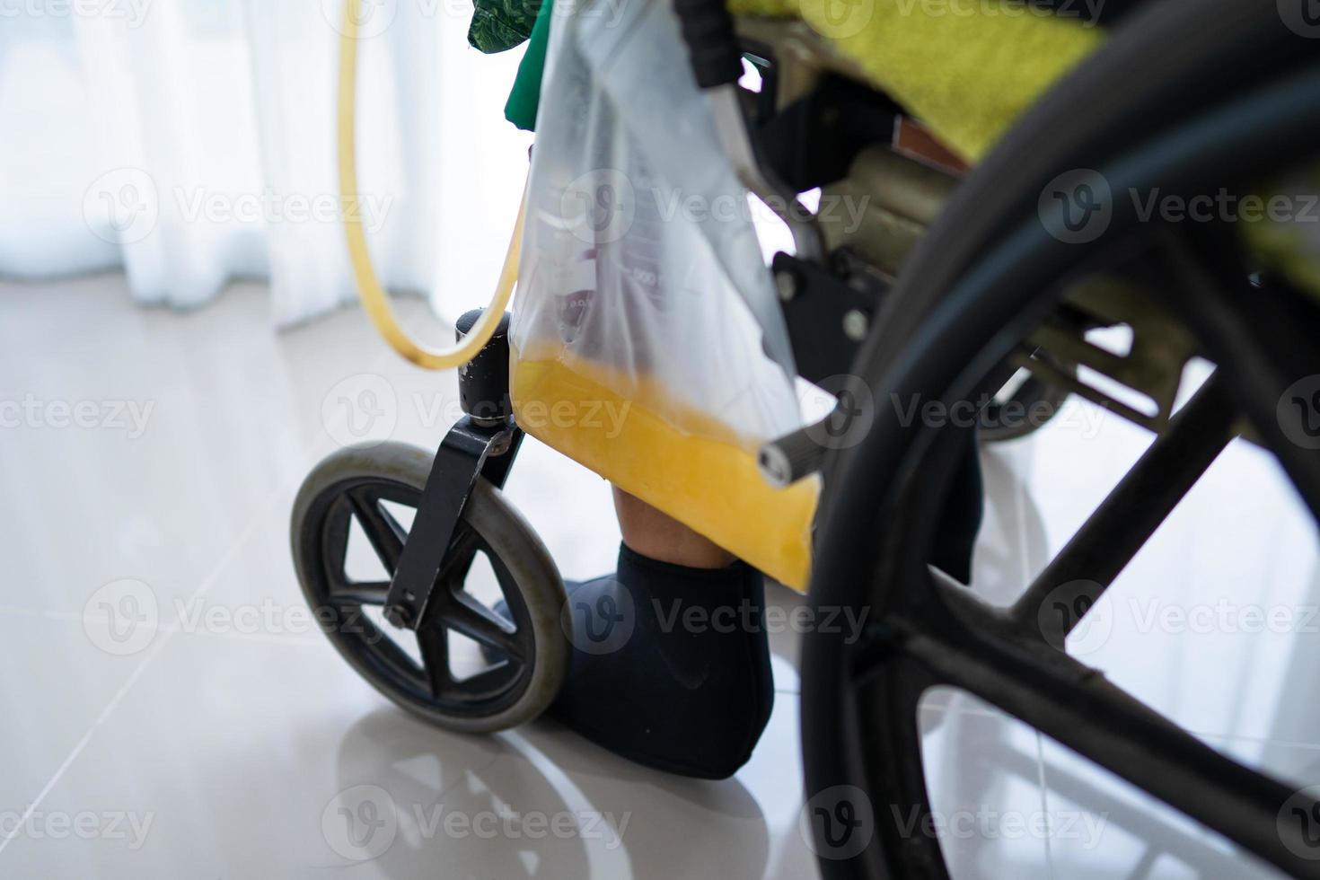 Asian lady woman patient sitting on wheelchair with urine bag in the hospital ward, healthy medical concept photo