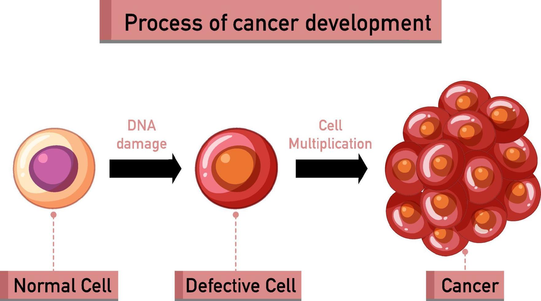 Process of cancer development infographic vector